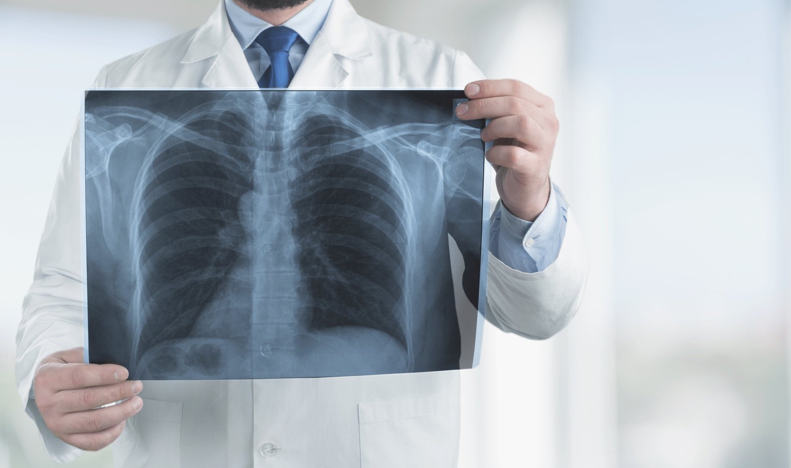 Doctor with Radiological Chest -Ray Film for Medical Diagnosis on Patient’S Health on Asthma,